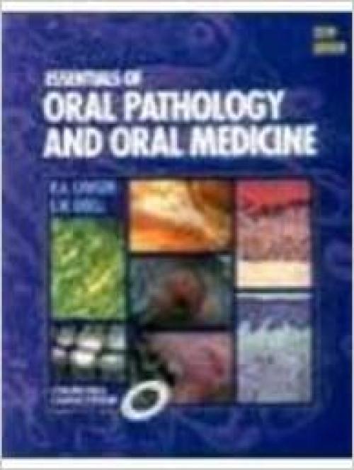  Cawson's Essentials of Oral Pathology and Oral Medicine 