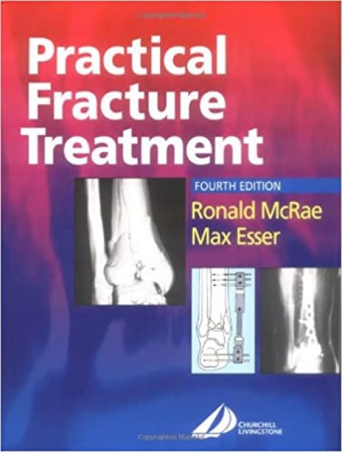  Practical Fracture Treatment, 4th Edition 