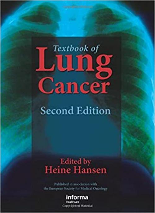  Textbook of Lung Cancer 