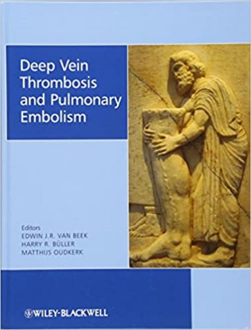  Deep Vein Thrombosis and Pulmonary Embolism 