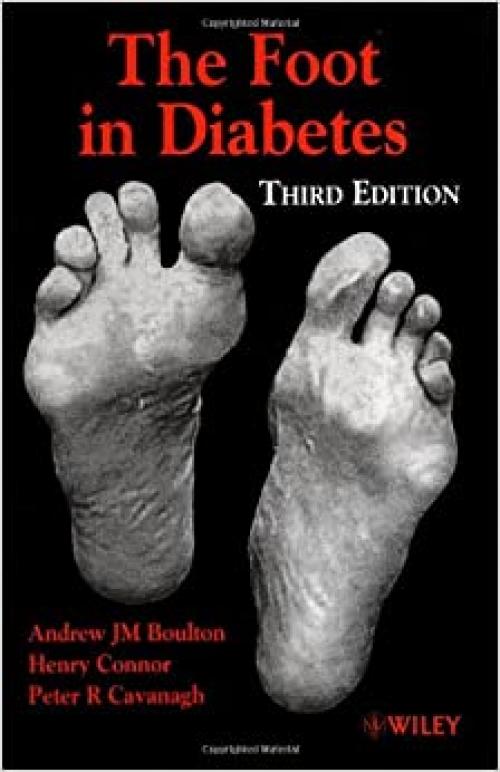  The Foot in Diabetes, 3rd Edition 