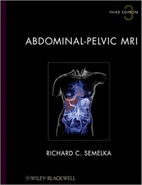  Abdominal-Pelvic MRI, 2 Volume Set 