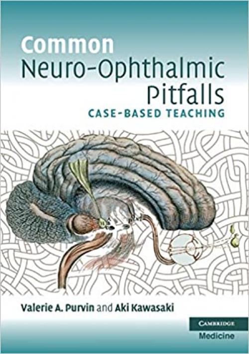  Common Neuro-Ophthalmic Pitfalls: Case-Based Teaching (Cambridge Medicine (Paperback)) 