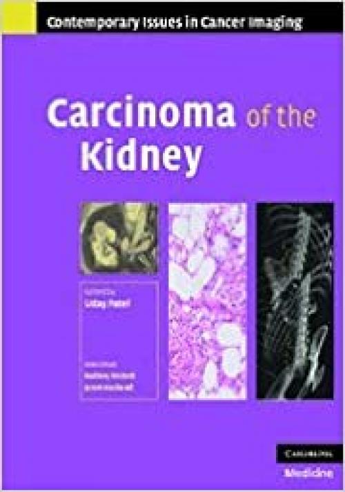  Carcinoma of the Kidney (Contemporary Issues in Cancer Imaging) 