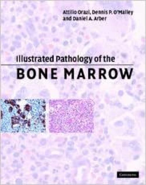  Illustrated Pathology of the Bone Marrow 