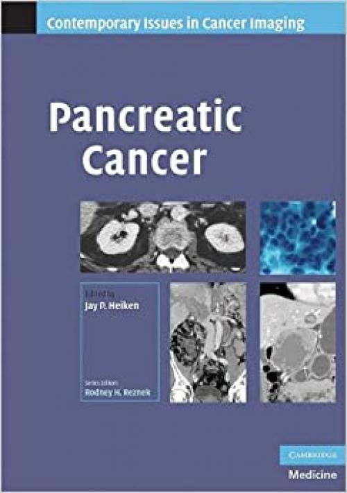  Pancreatic Cancer (Contemporary Issues in Cancer Imaging) 