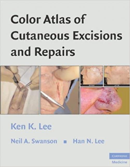  Color Atlas of Cutaneous Excisions and Repairs 