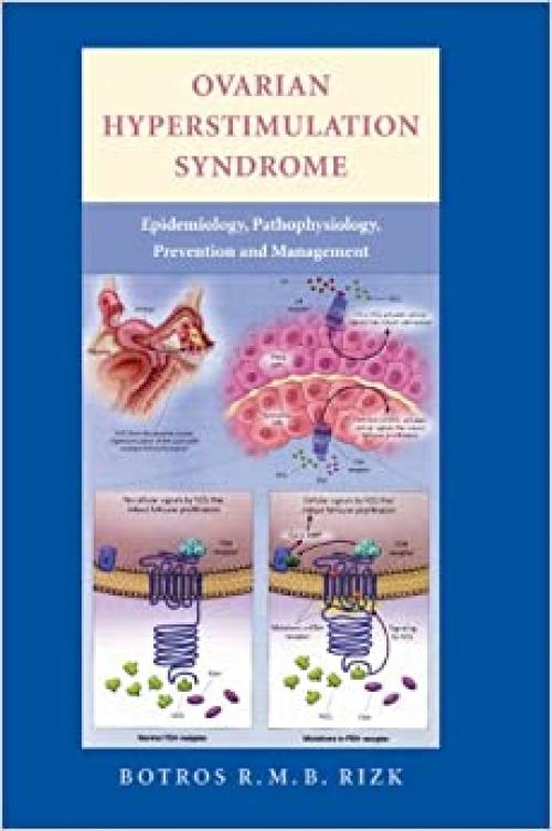  Ovarian Hyperstimulation Syndrome: Epidemiology, Pathophysiology, Prevention and Management 