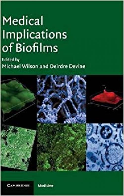  Medical Implications of Biofilms 