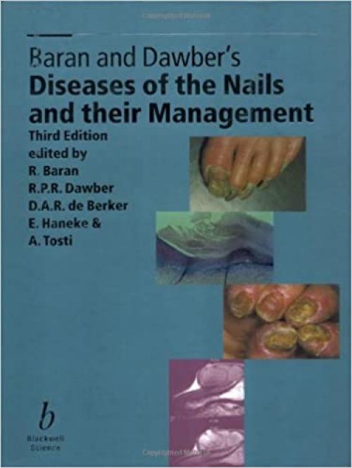  Diseases of the Nails and Their Management 