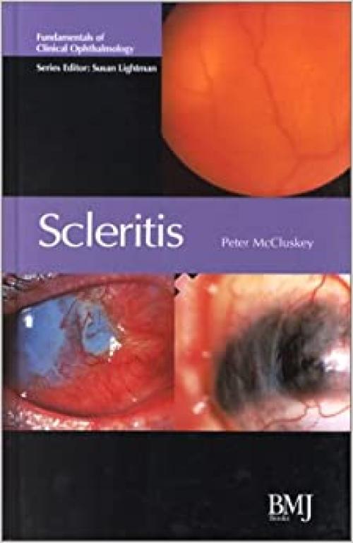  Scleritis: Fundamentals of Clinical Ophthalmology 