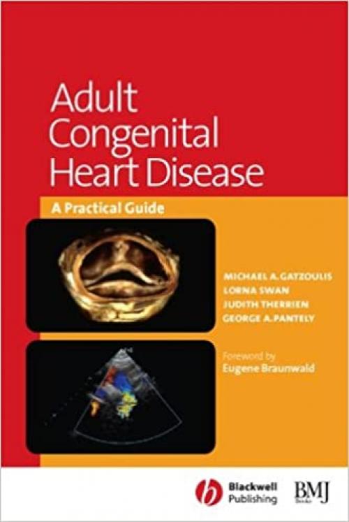  Adult Congenital Heart Disease: A Practical Guide 