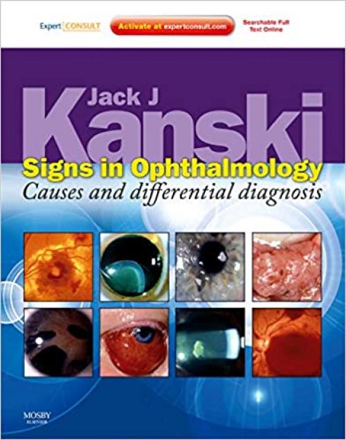  Signs in Ophthalmology: Causes and Differential Diagnosis: Expert Consult - Online and Print 