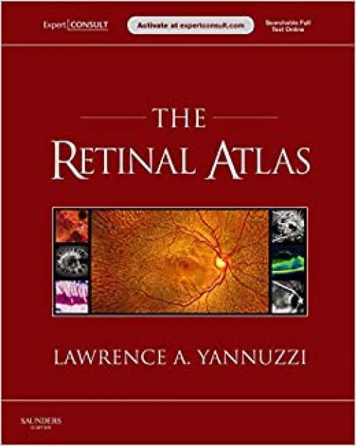  The Retinal Atlas: Expert Consult - Online and Print 