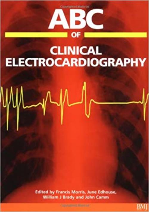  ABC of Clinical Electrocardiography (ABC Series) 