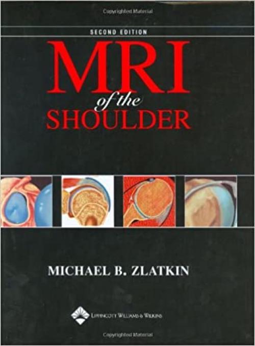  Mri of the Shoulder 