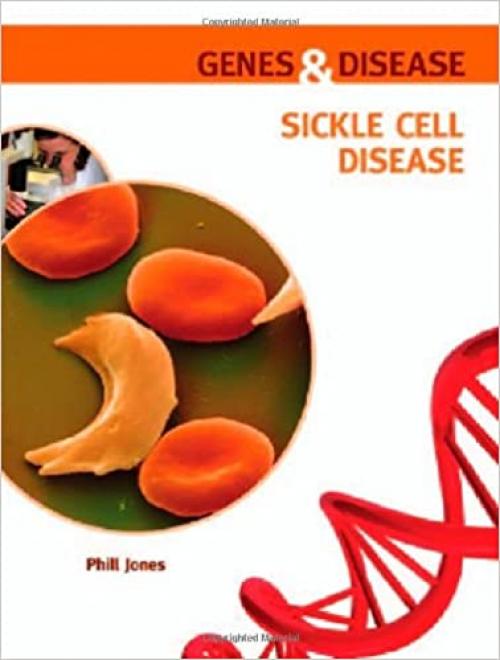  Sickle Cell Disease (Genes & Disease) 