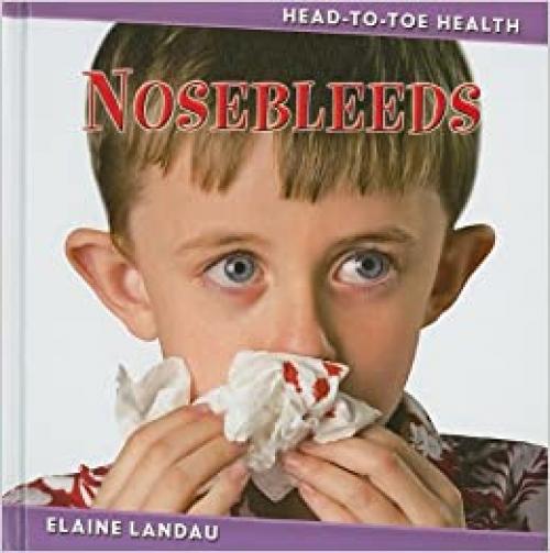  Nosebleeds (Head-To-Toe Health) 