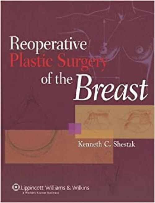  Reoperative Plastic Surgery of the Breast 