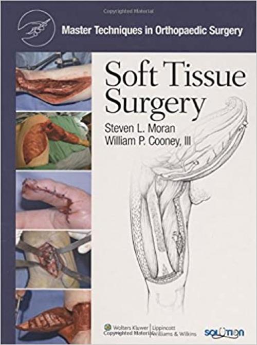  Soft Tissue Surgery (Master Techniques in Orthopaedic Surgery) 