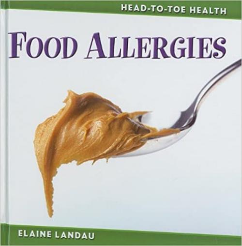  Food Allergies (Head-To-Toe Health) 