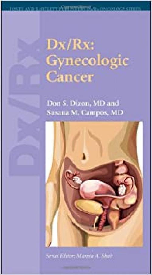  Dx/Rx: Gynecologic Cancer (Jones and Bartlett Publishers Dx/Rx Oncology Series) 