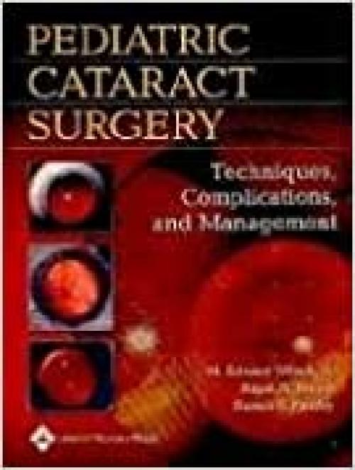  Pediatric Cataract Surgery: Techniques, Complications, And Management 