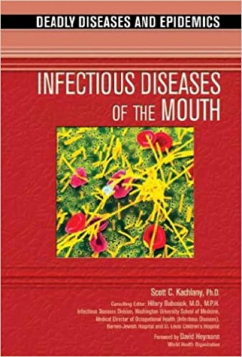  Infectious Diseases of the Mouth (Deadly Diseases & Epidemics (Hardcover)) 