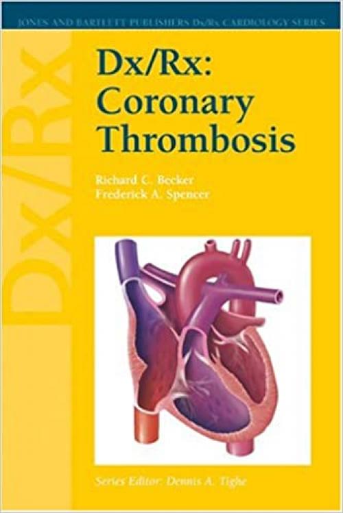  Dx/Rx: Coronary Thrombosis (Dx/Rx Cardiology Series) 