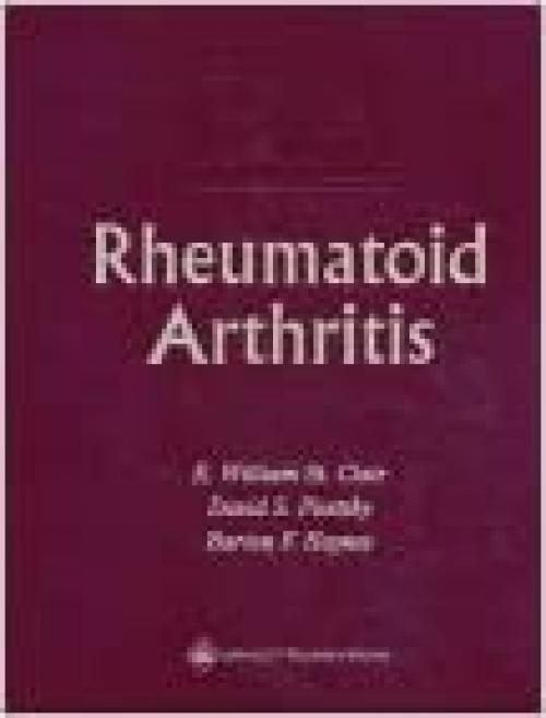  Rheumatoid Arthritis 