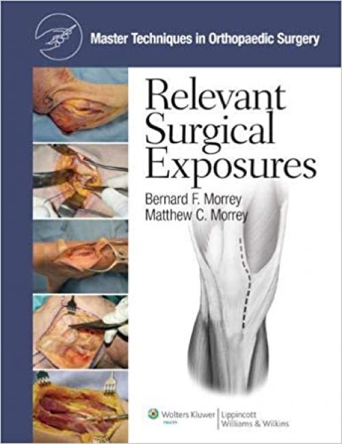  Relevant Surgical Exposures (Master Techniques in Orthopaedic Surgery) 