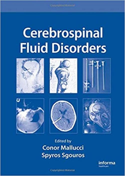  Cerebrospinal Fluid Disorders 