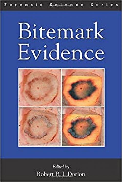  Bitemark Evidence (International Forensic Science and Investigation) 