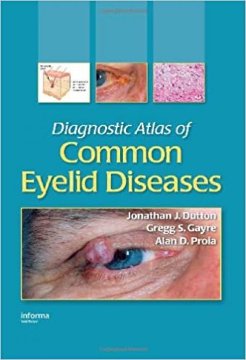  Diagnostic Atlas of Common Eyelid Diseases 