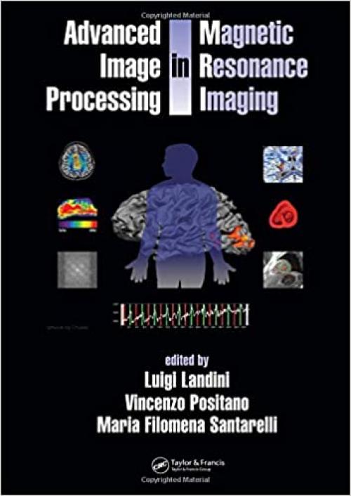  Advanced Image Processing in Magnetic Resonance Imaging (Signal Processing and Communications) 