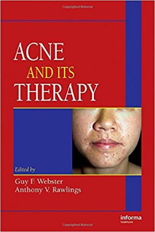  Acne and Its Therapy (Basic and Clinical Dermatology) 