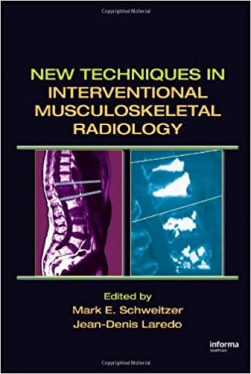  New Techniques in Interventional Musculoskeletal Radiology 