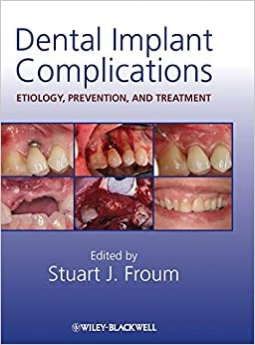  Dental Implant Complications: Etiology, Prevention, and Treatment 