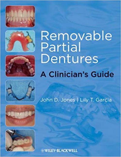  Removable Partial Dentures: A Clinician's Guide 