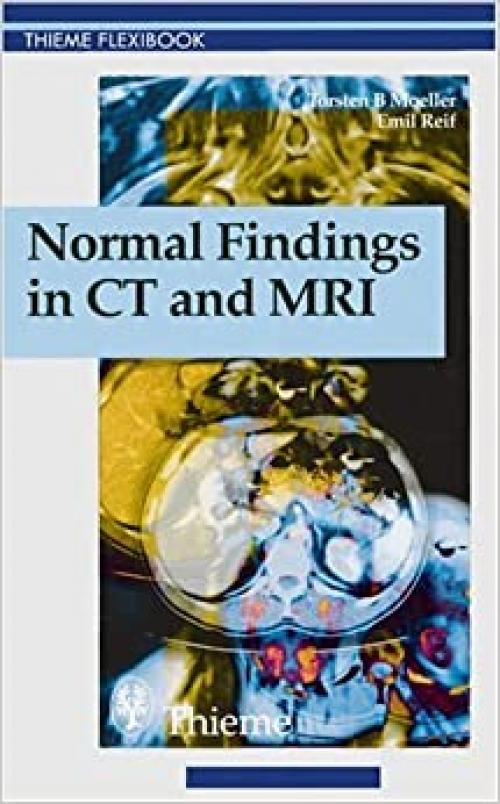  Normal Findings in CT and MRI (Thieme Flexibook) 