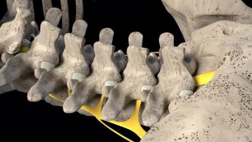 Videohive - Spinal Nerve Inflammation - 32394785 - 32394785