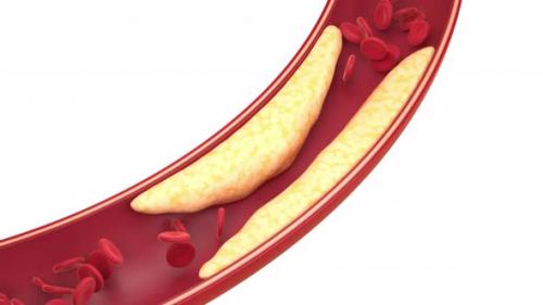 Videohive - Fat and cells in blood vessels - 32485662 - 32485662