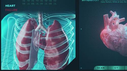 Videohive - Heart Failure and Functions HUD - 32670477 - 32670477