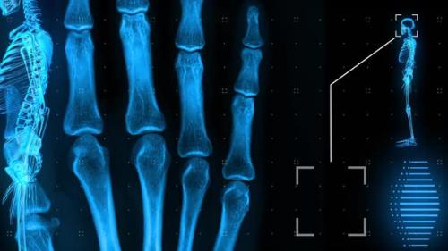 Videohive - Human MRI Scanning Bones - 32677678 - 32677678