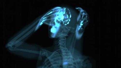 Videohive - 4K abstract Xray anatomy concept of a headache - 32933868 - 32933868