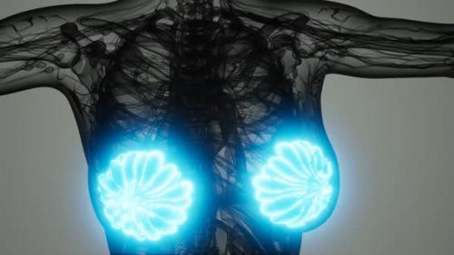 Videohive - Medical Scan of Woman Breast Cancer - 32988267 - 32988267