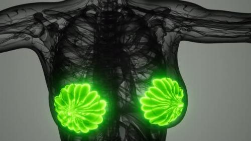 Videohive - Medical Scan of Woman Breast Cancer - 35143989 - 35143989