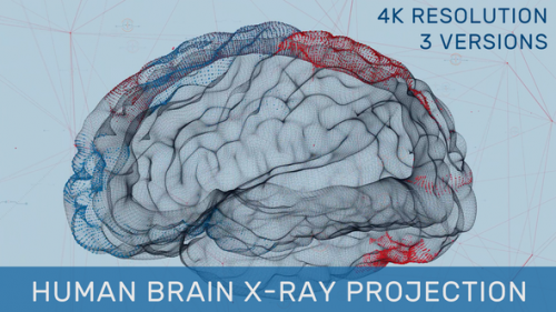 Videohive - Human Brain X-Ray Projection - 35307230 - 35307230