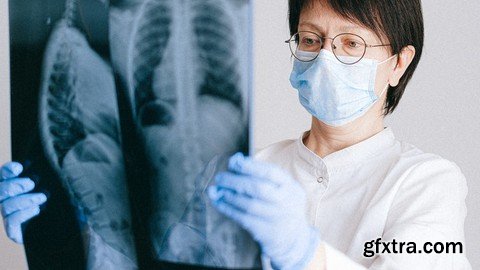 Data Science: CNN & OpenCV : Chest XRAY-Pneumonia Detection