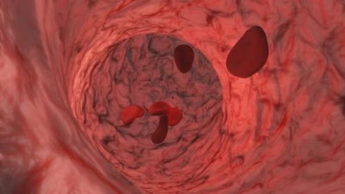 Videohive - Blood cells moving through the vein. Erythrocytes and platelets. - 41923934 - 41923934